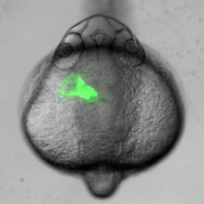 Green fluorescent protein in the asymmetrically positioned heart tube